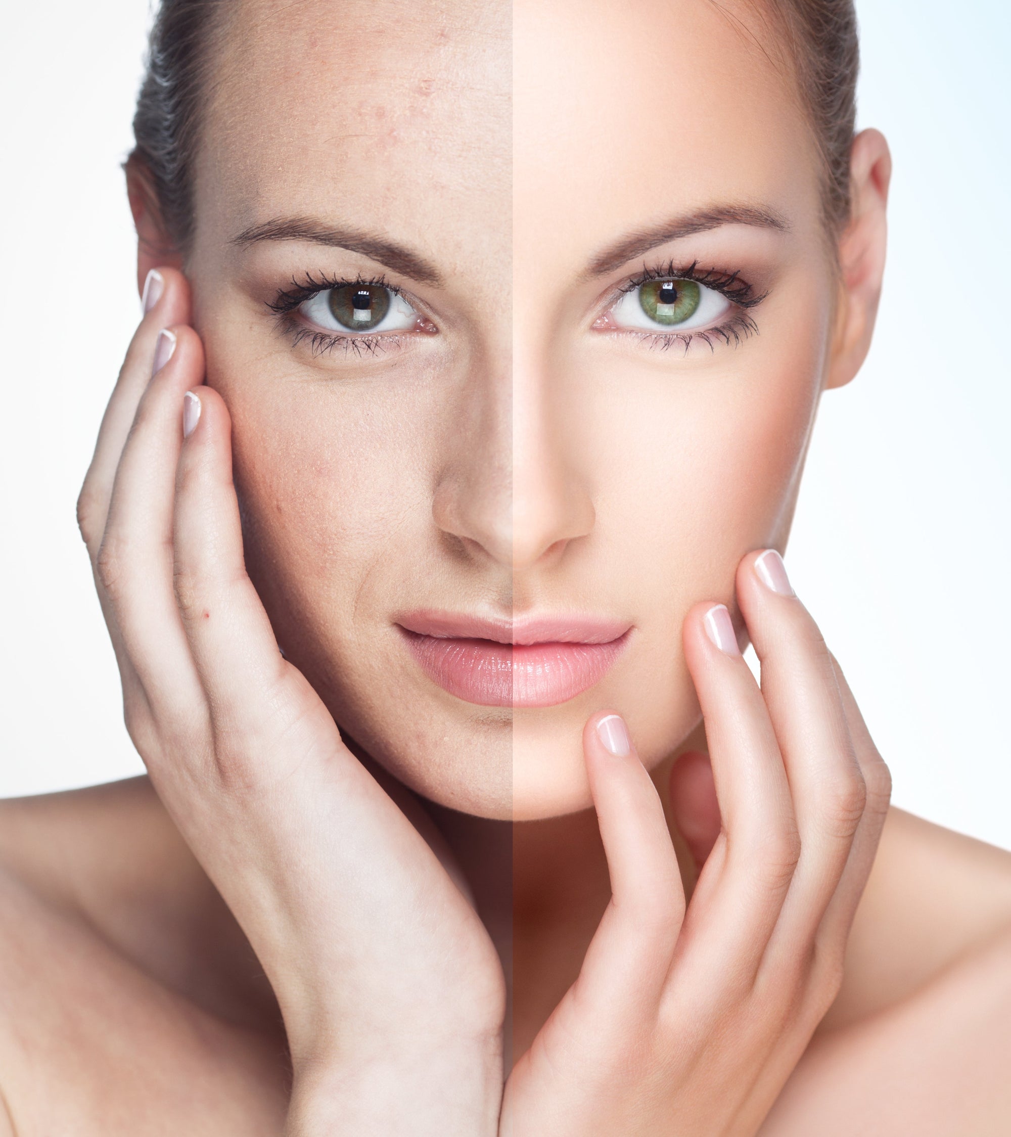 It's Laser Season! Rejuvenate, Refresh, and Reveal Your Best Skin