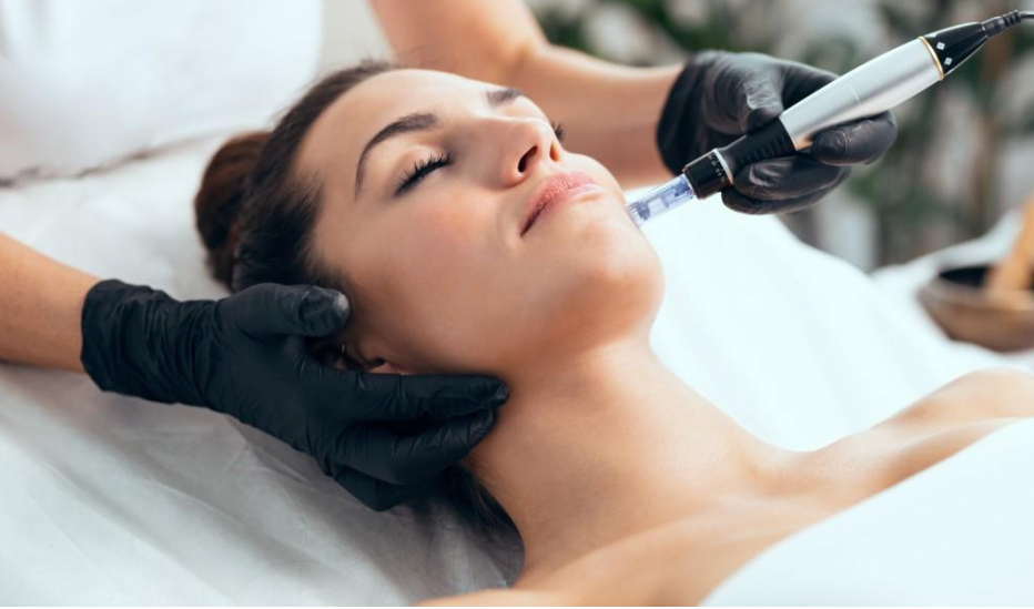 Microneedling with Platelet-Rich Plasma (PRP)